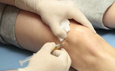 PRP Treatment at Toledo Clinic Sports Medicine – Evidence‑Based Orthobiologic Care