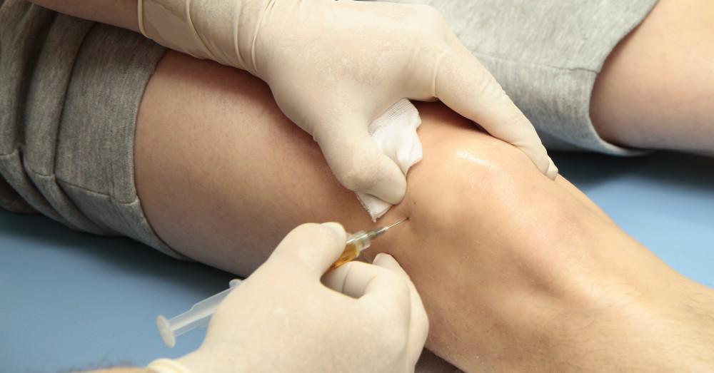 PRP Treatment Toledo Ohio